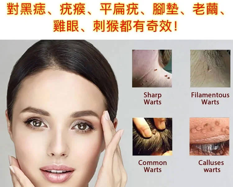 kinbt扁平疣軟膏1728128169947222.jpg kinbt扁平疣軟膏3.jpg